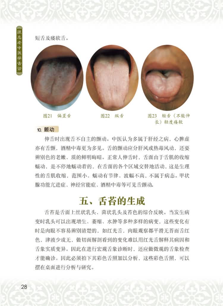修订版 中医舌诊 舌诊基础知识 舌头 舌苔 舌象 望舌识病图解 望舌