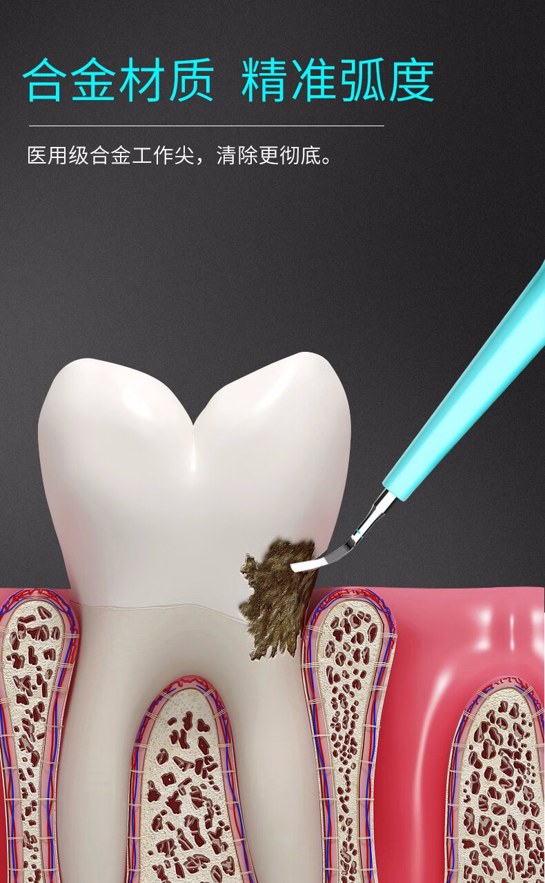 华宝源牙结石去除器洗牙超声波洁牙器洗牙器自动家用去牙石清除器牙垢