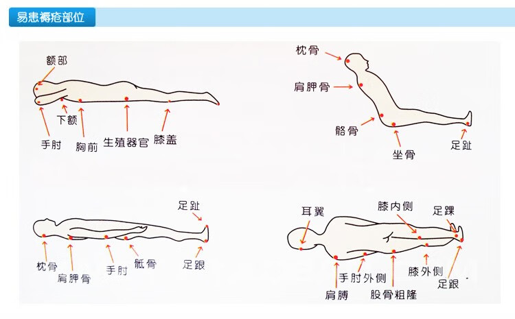 鱼跃yuwell电动防褥疮气垫护理床家用翻身垫充气床垫医用护理气垫床
