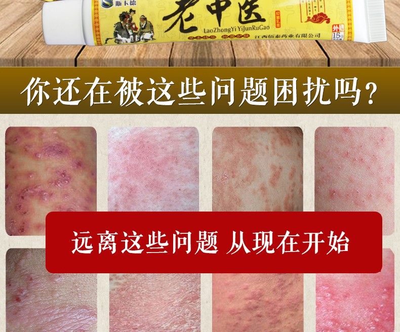 瘙痒阴囊潮湿止痒膏皮肤抑菌膏大腿内侧痒真菌感染癣痒灵湿毒王软膏夫
