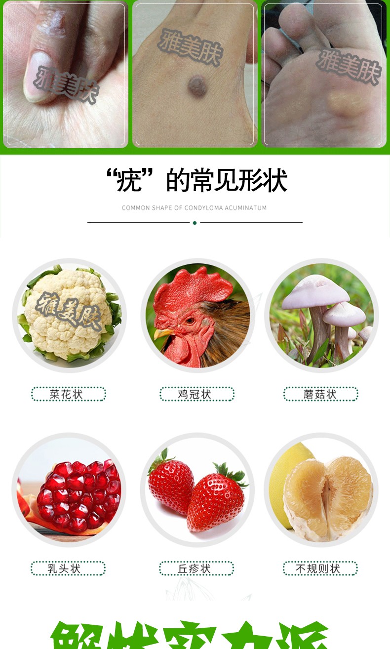 雅美肤(yameifu) 广雅瘊疣平 广雅瘊疣平 10ml 10g/盒