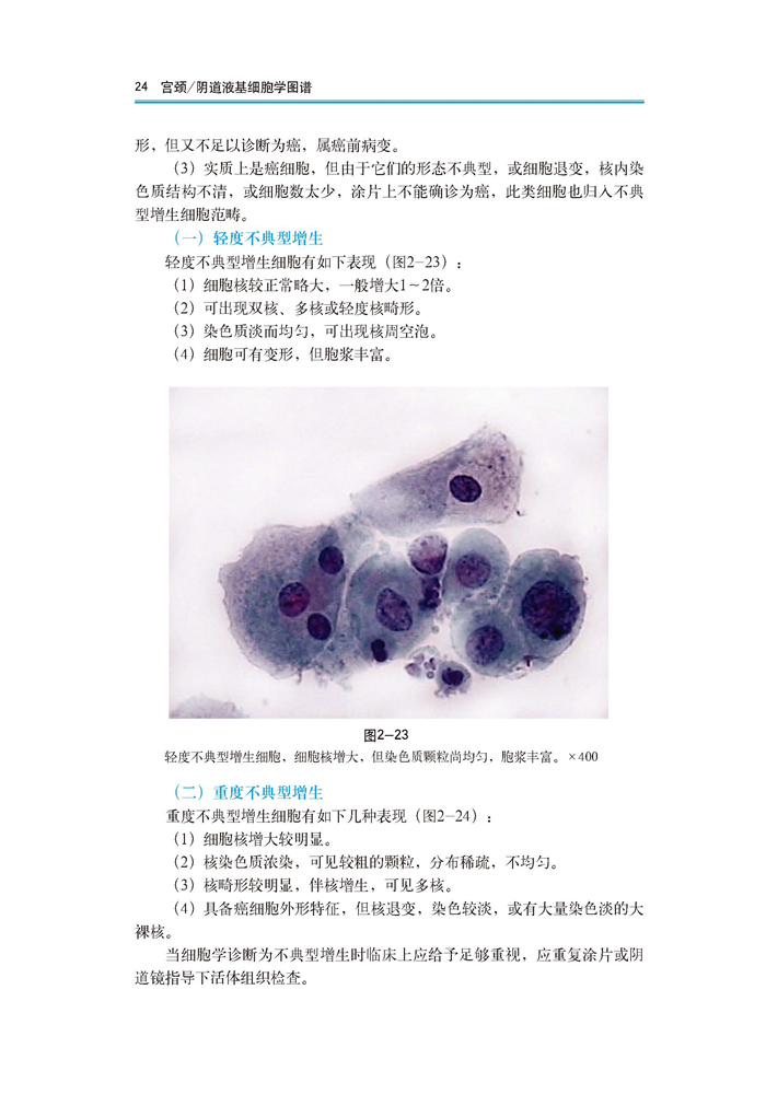 正版书籍 宫颈/阴道液基细胞学图谱