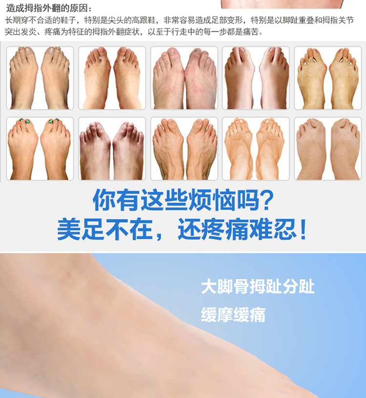 
                                        胜诺 大脚拇指外翻矫正器 拇外翻脚趾外翻矫正器 成人款 随机款1对装                