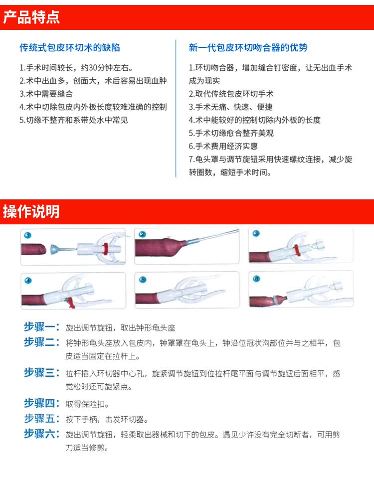 医用一次性使用包皮切割吻合器切包皮割包皮包皮过长割包皮环切器缝合
