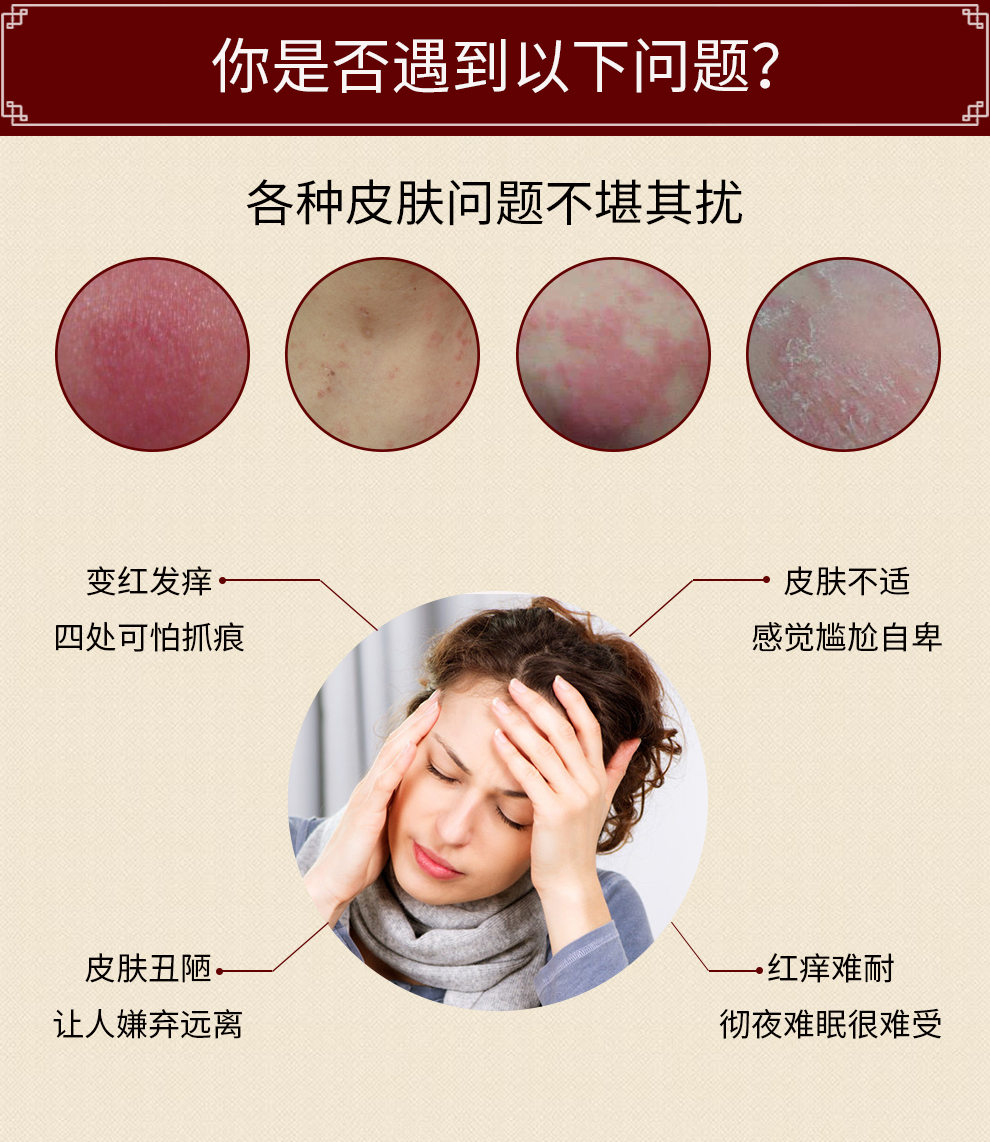 诚敬牌舒享抑菌膏原断痒拔毒膏软膏皮肤瘙痒止痒膏可搭大腿内侧一抹灵