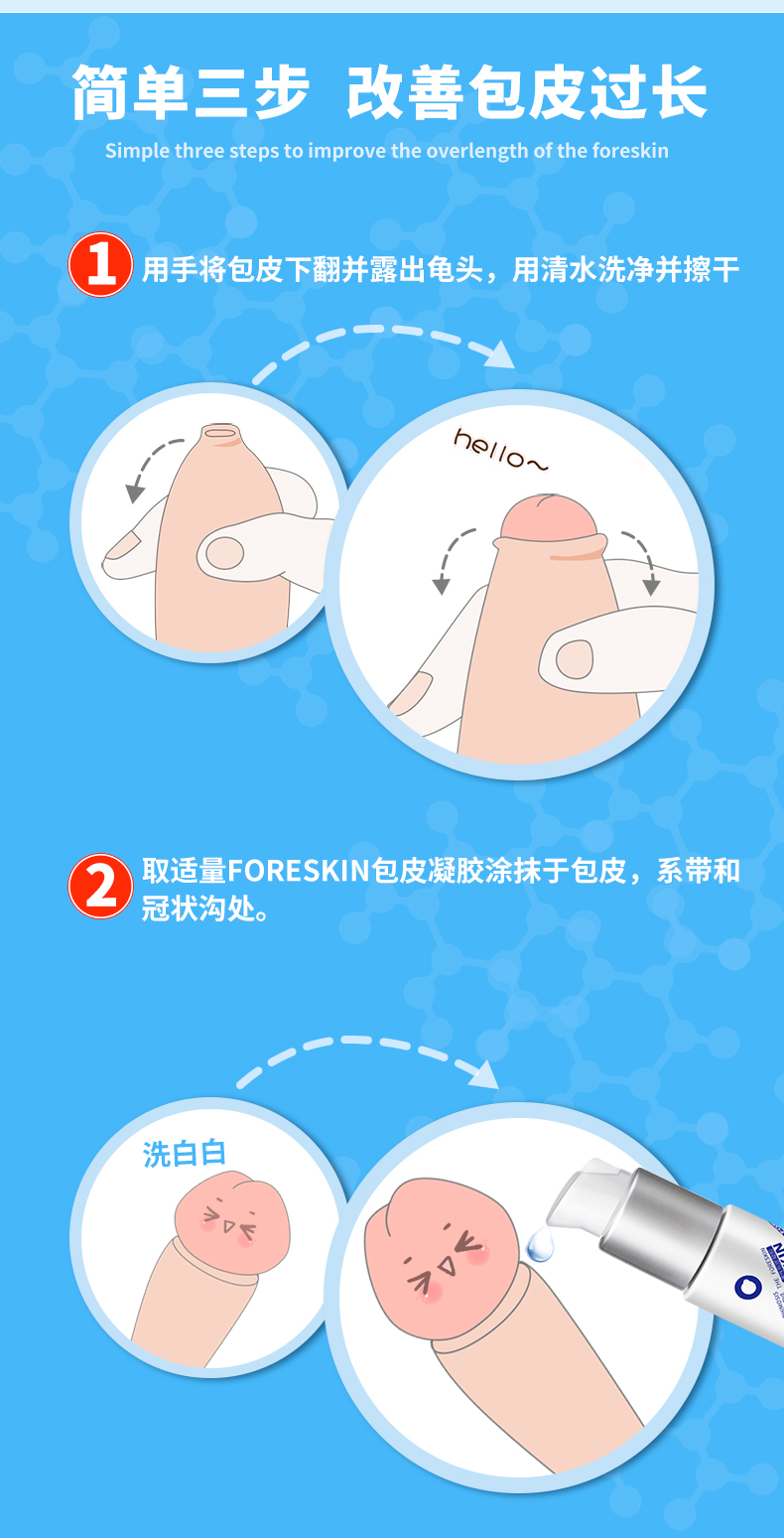 韩式环切器图解图片