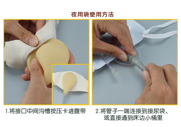 新辉 造口腰带 膀胱腰侧袋 尿路造口袋小便袋 日用 夜用 两用 日用 夜