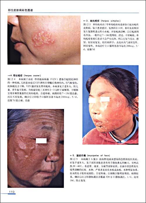 《部位皮肤病彩色图谱 虞瑞尧 医学 书籍》【摘要 书评 试读】- 京东