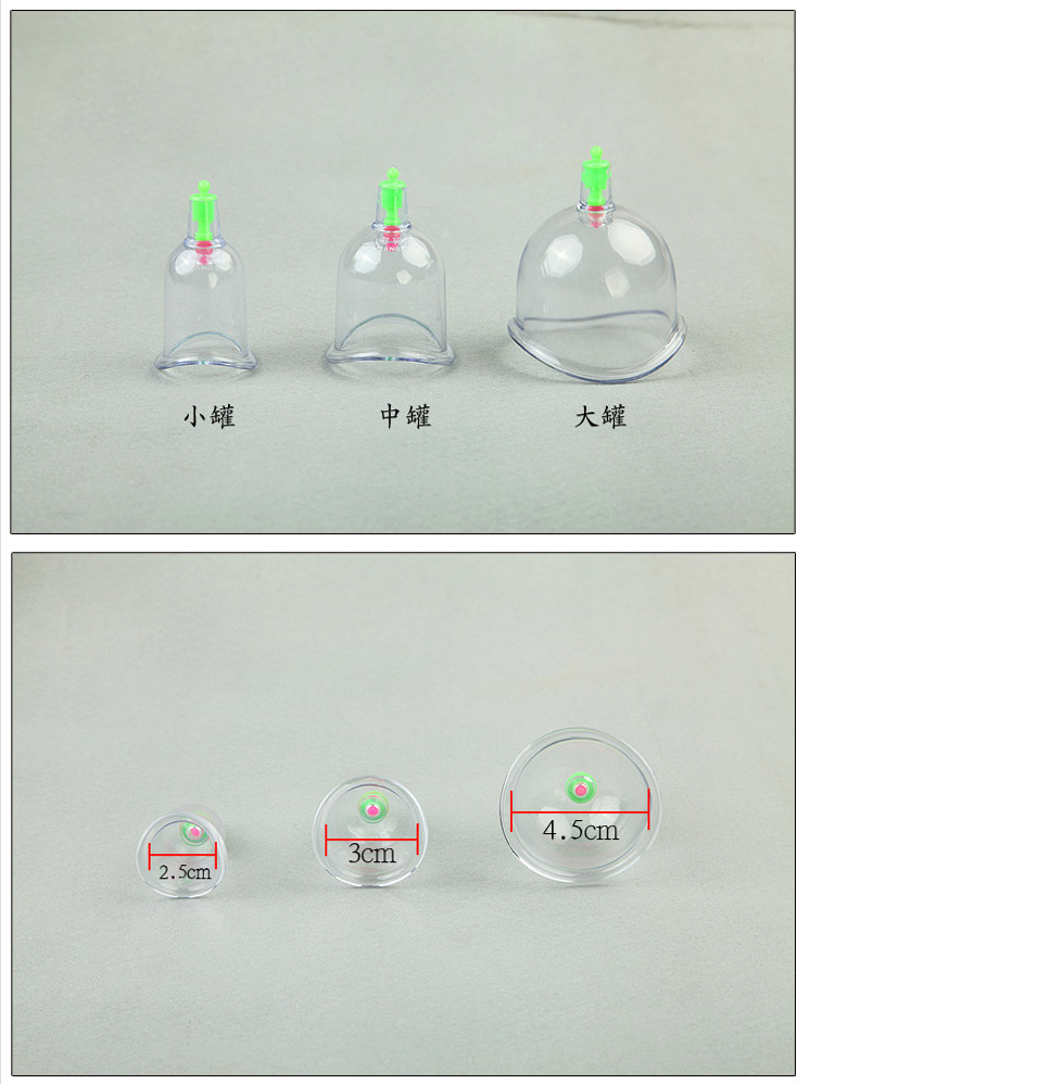 康祝关节罐拔罐器盒装真空加厚关节异形罐3个装u型罐气罐关节罐拔罐枪