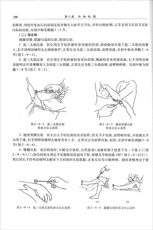 桡骨膜反射检查图片