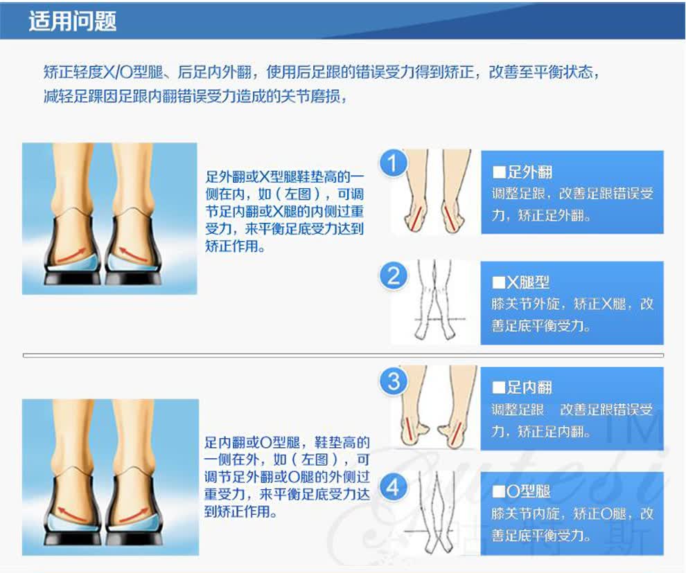 萨缤妮内外八字腿内外翻矫正鞋垫儿童成人xo型腿矫正垫男女士外侧磨鞋
