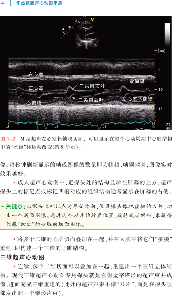 《新华书店 华盛顿超声心动图手册 瑞威瑞泽林格姆 9787543335929