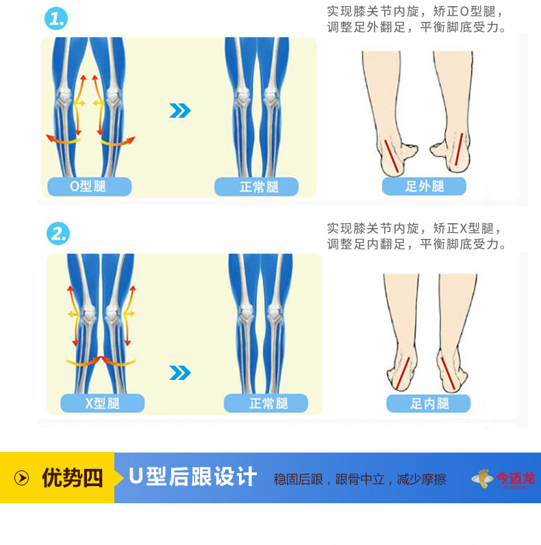 男运动鞋垫女吸汗除臭防臭鞋垫足外翻内外八字外x/o型腿矫正足弓垫男