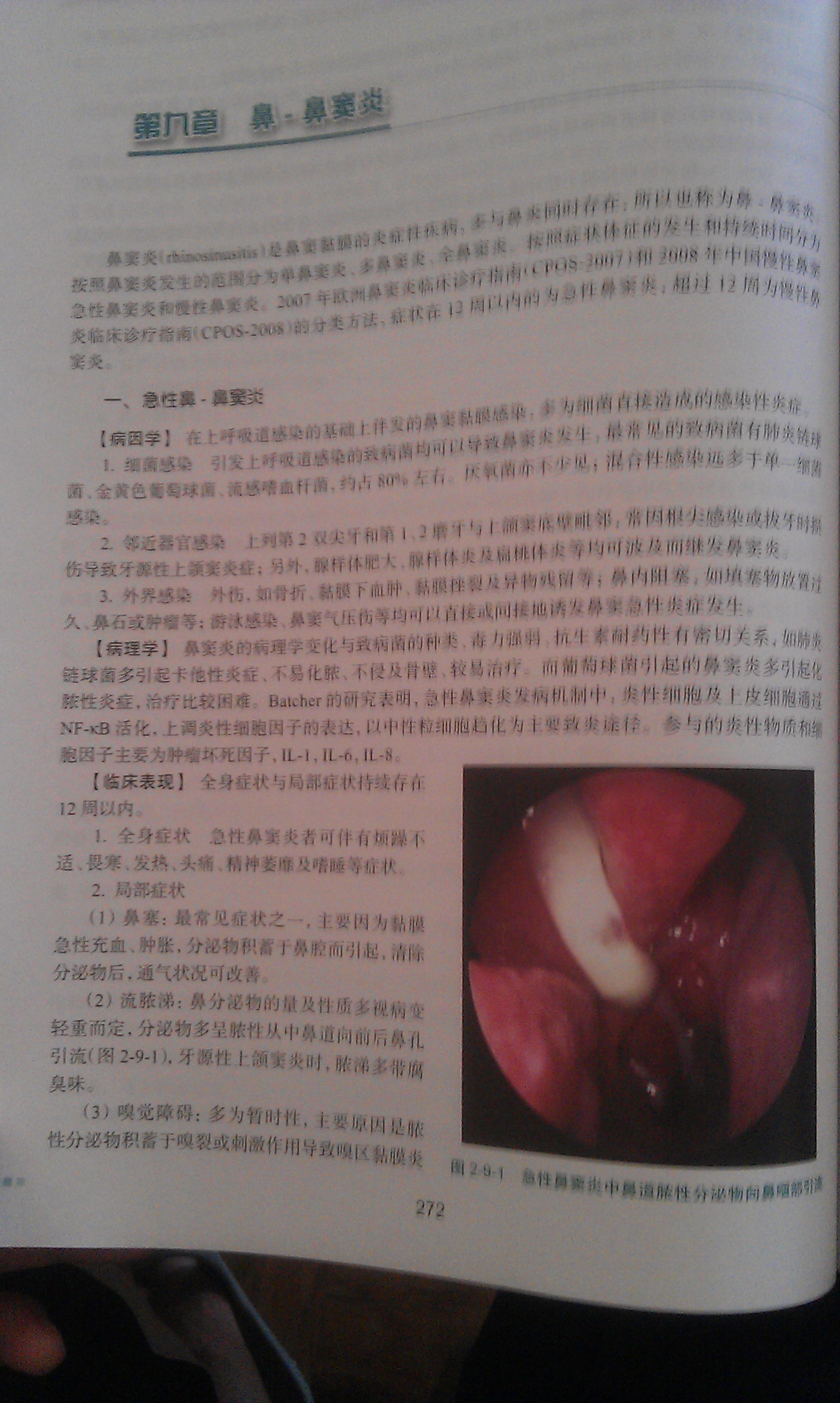 耳鼻咽喉头颈外科学 孔维佳/2版/八年制十一五规划/供8年制及7年制临床医学等专业用 实拍图