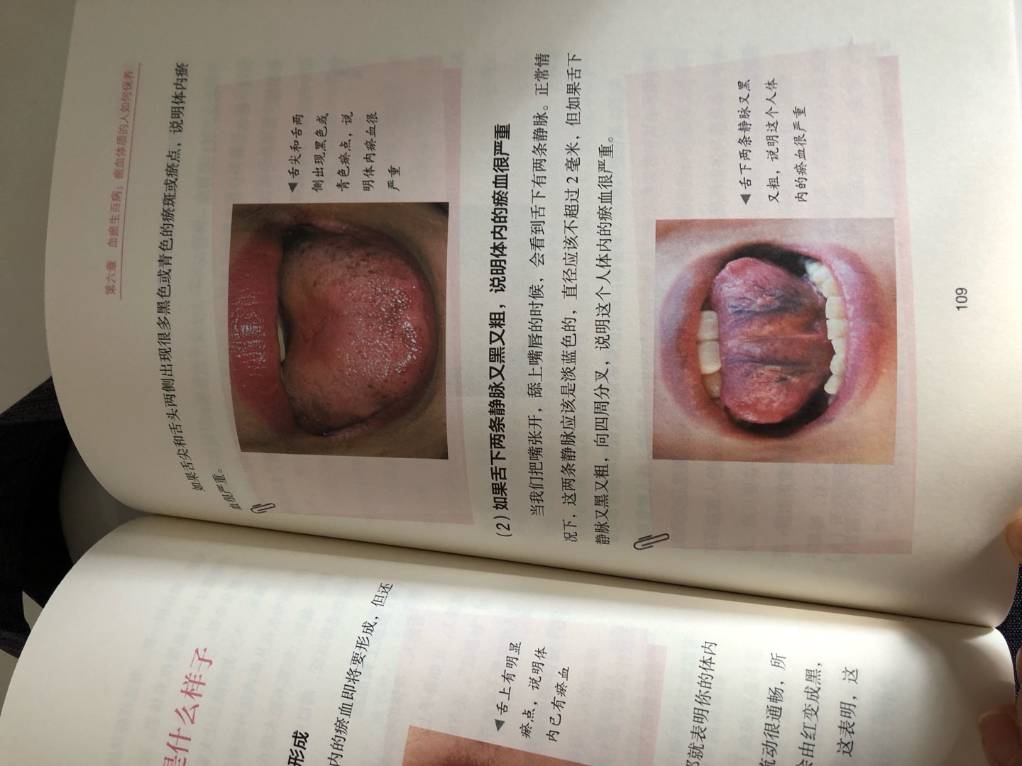 舌诊对居家自己保健亦或是门诊医疗都非常重要！这本书内容详实，图片清晰真实。重点推荐的一本书！