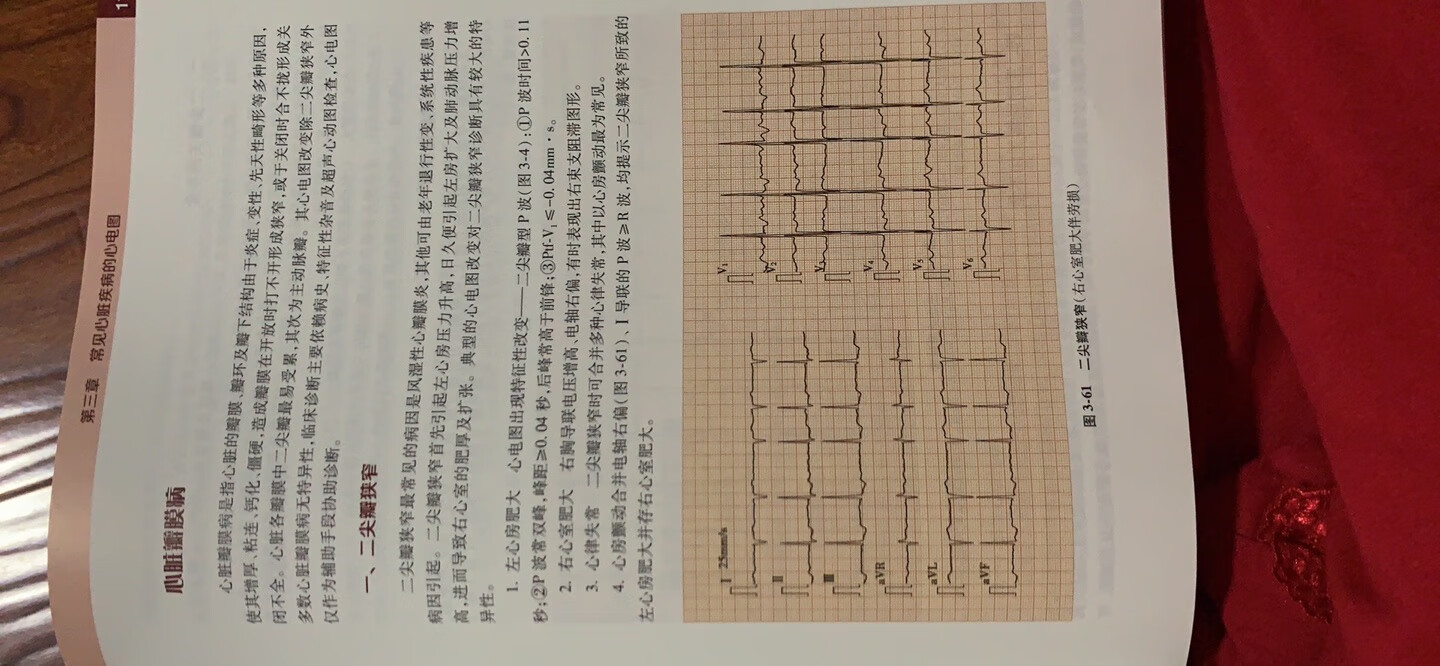 包装完好，图多便于理解。。。