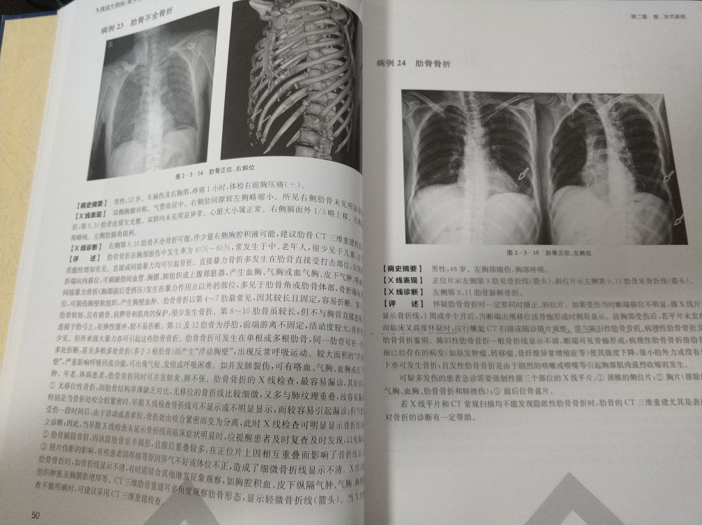 在图书馆无意中发现的一本书，虽写的很笼统，但胜在病例丰富，薄薄的一本书笼统的将绝大部分病种涵盖其中，适合影像专业的医学生和刚工作的放射科医生拜读，不足之处就是X线表现写的过于笼统，只有阳性征象而无阴性征象，如果X线表现写的详细些，完全可作为平时写报告时的参考书