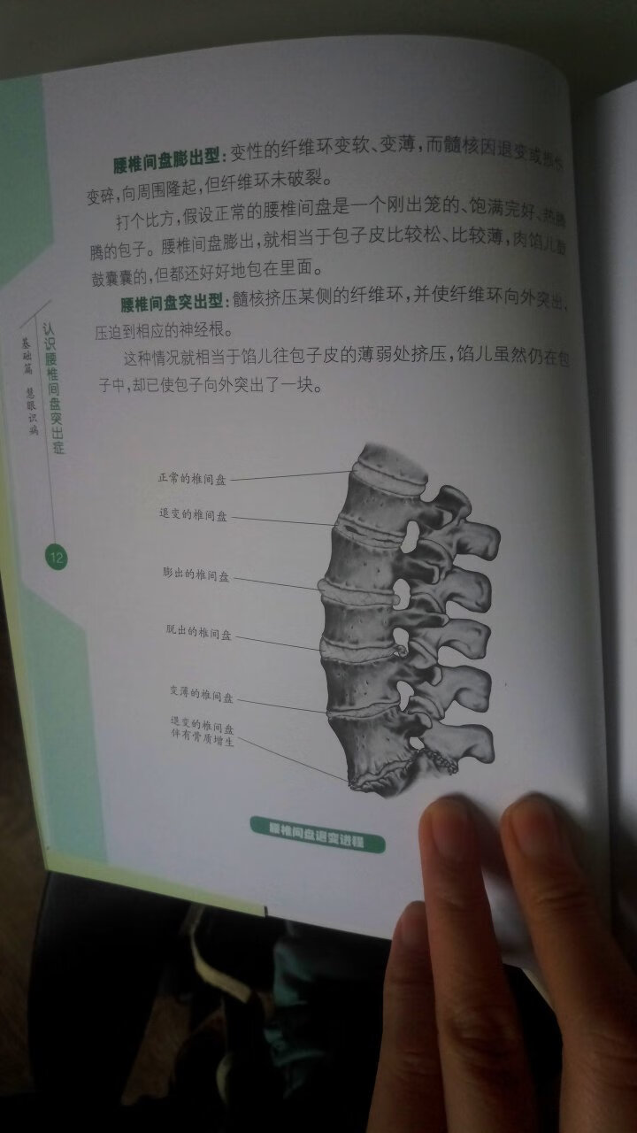 快递速度很给力，内容通俗易懂，很适合有腰间盘突出患者做有针对性的预防治疗和锻炼，受益匪浅，极力推荐