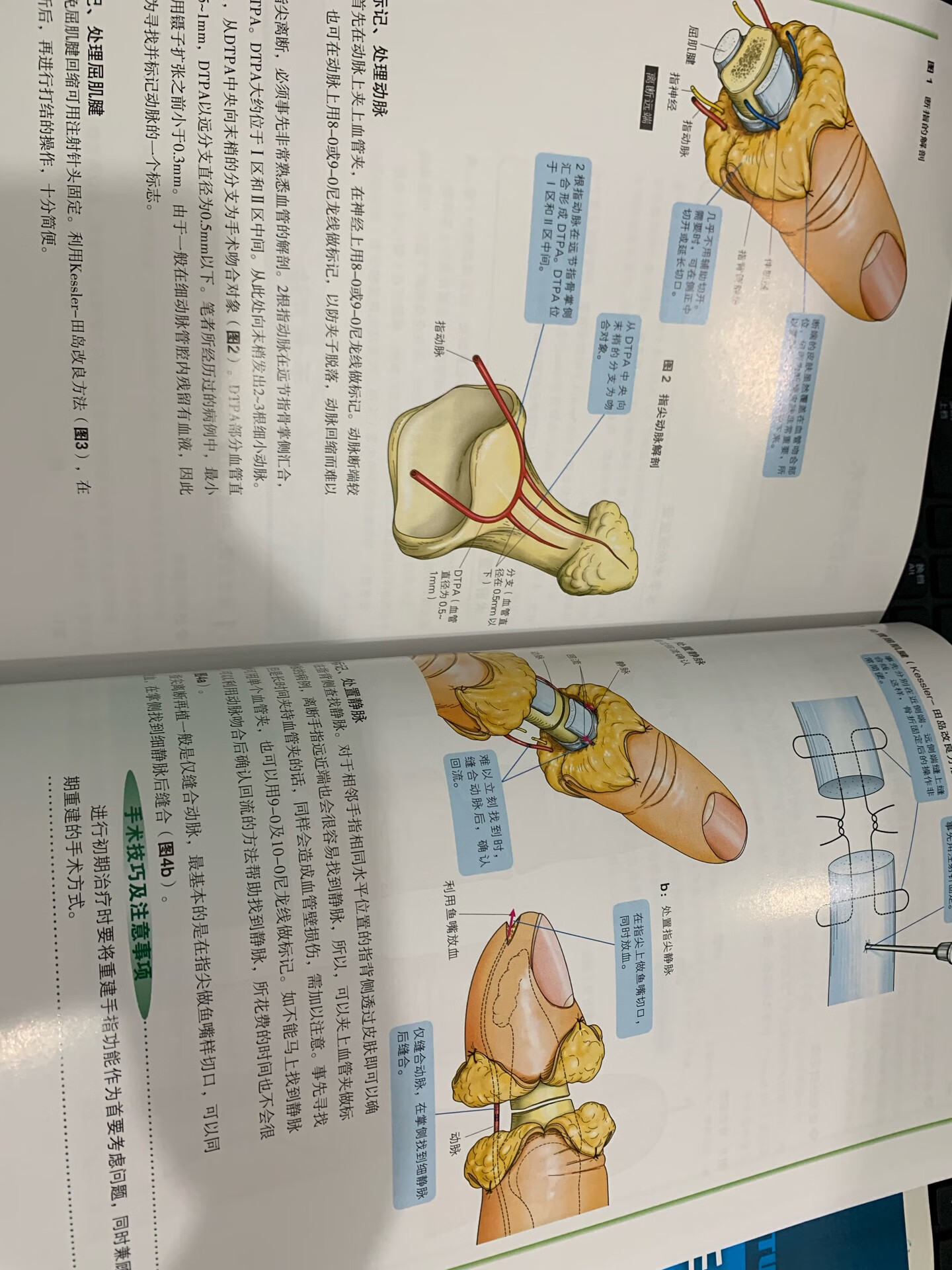 书的质量很好，是彩色的，一些手外科必知的知识