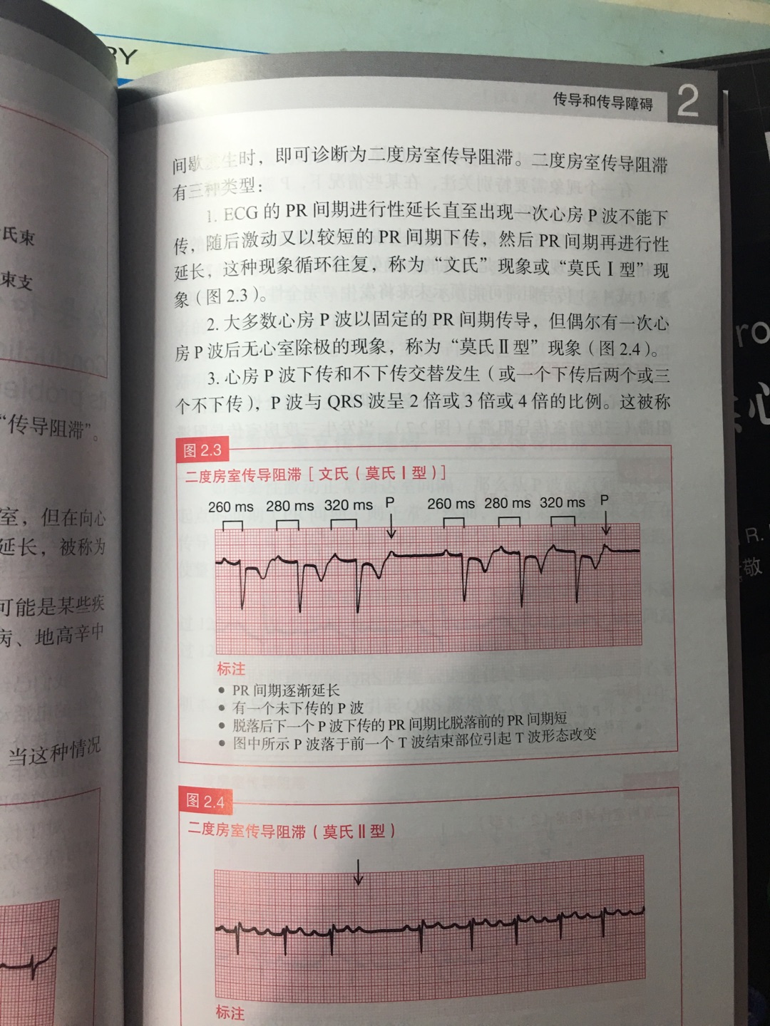 书的装帧质量太差！基本是看一页掉一页！能不能认真点？！经典的书装帧成这样！痛惜