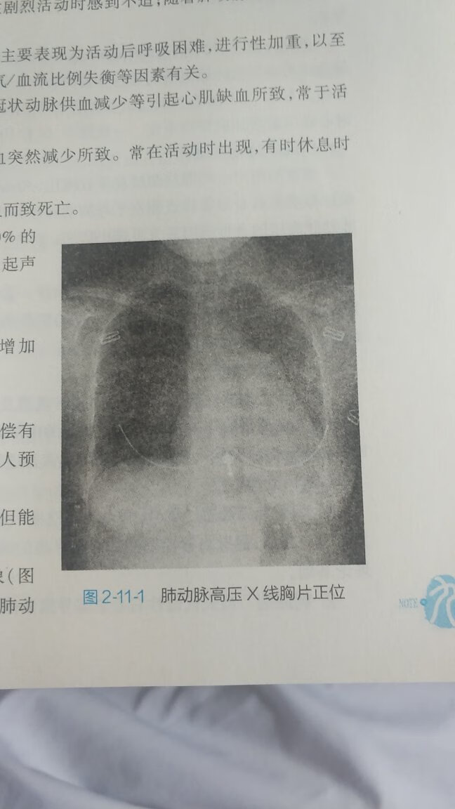 纸张质量差，图像不清晰