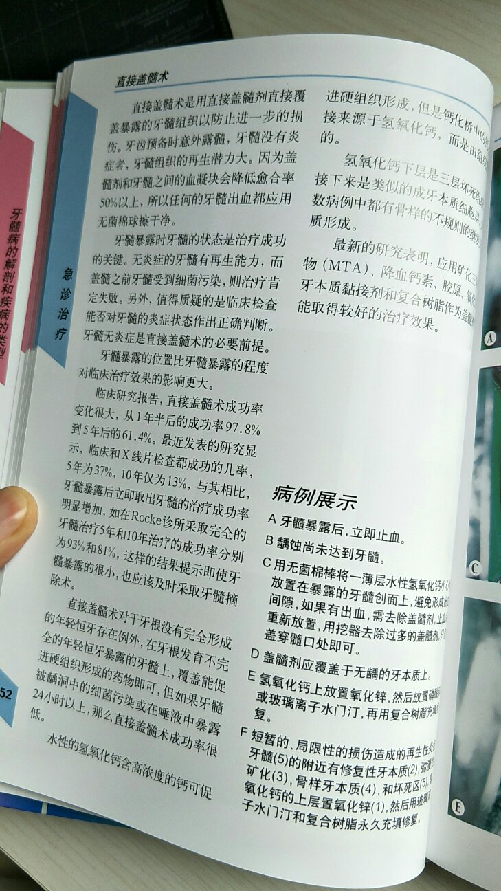 双十一图书节买的书，利用了优惠券，非常划算，在购物还是很划得来的，收到书之后也看了下，挺好的。快递就没得说了，非常快，包装严密，只不过本地有些书没有，得从北京调货，所以个别书会晚到，以后有活动还是继续购买！