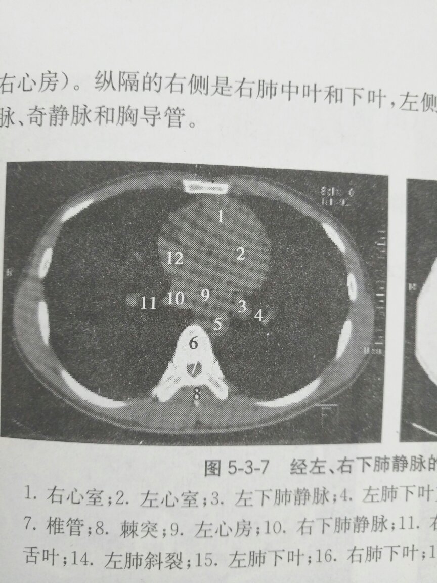 图片不是很清晰，其他的还好。