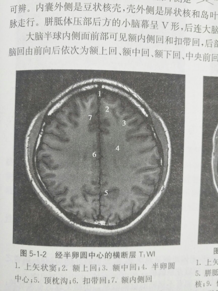 图片不是很清晰，其他的还好。