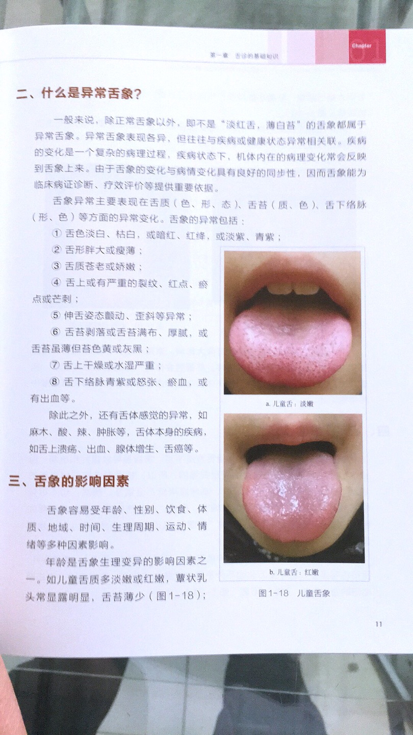这本书舌诊临床非常棒的一部书舌诊临床书籍，图为并茂，注解详细，贴合临床实际，有舌苔有症状有治法有方药。