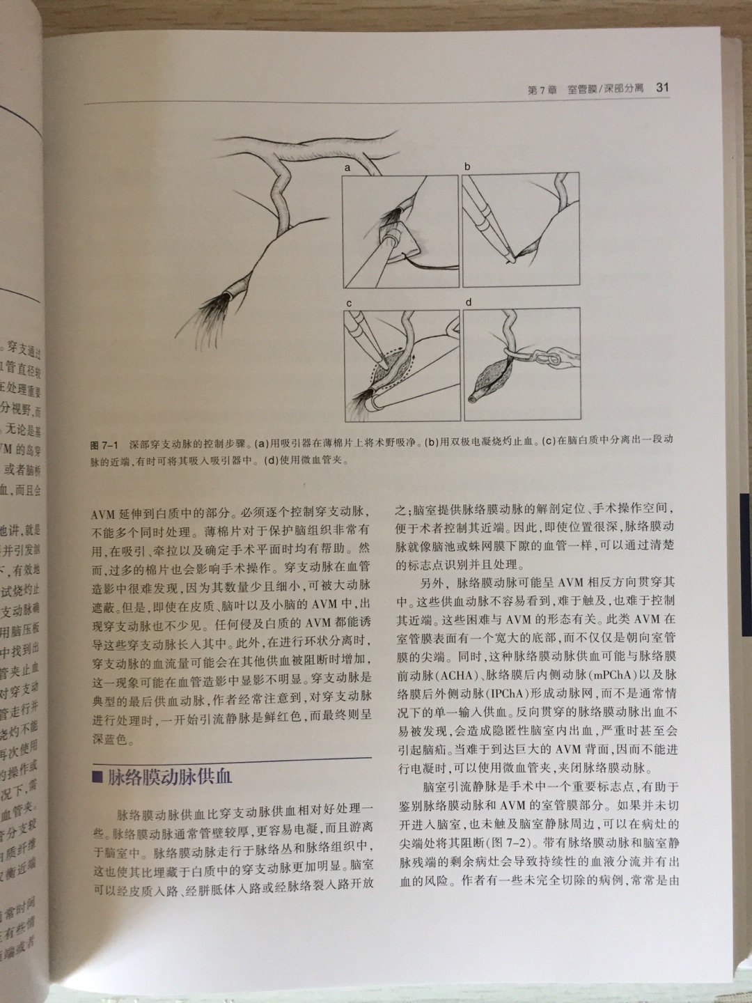 物流很快，快递小哥态度好。从华东调货，照例一个塑料袋。本身有塑封，书角有磕碰的迹象，不过还好吧。彩印，图文并茂。