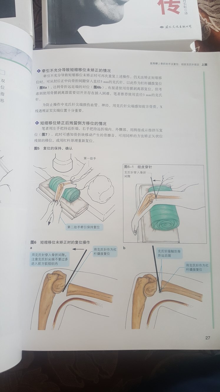 印刷质量不错，买的有点多，不知道什么时候才能读完啊