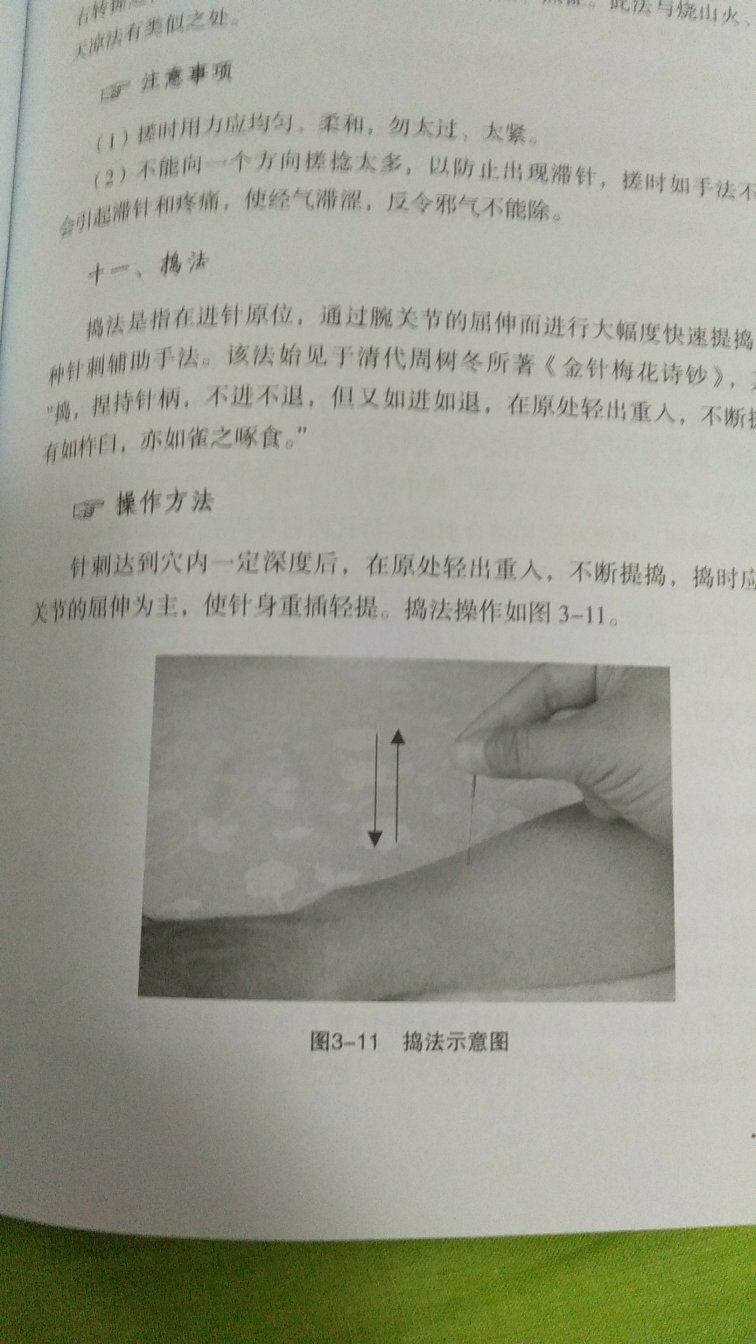 此书介绍了一些不常见的钍灸手法。