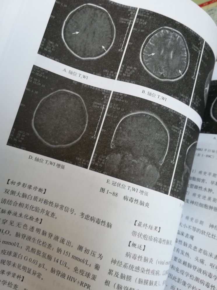 纸张粗糙，图像清晰度差，书写错误，典型的盗版！失望了?