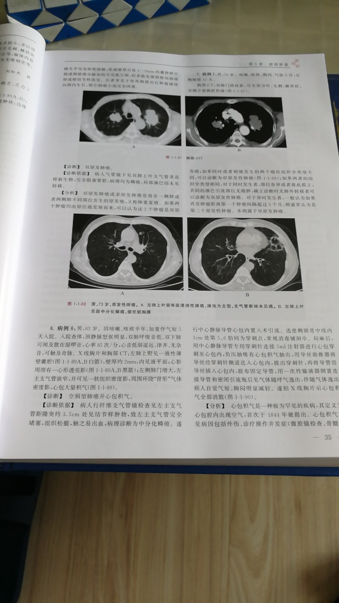 好好好，很不错的一本书，对临床医生来说非常实用的一本书，字迹清楚 图片清晰。