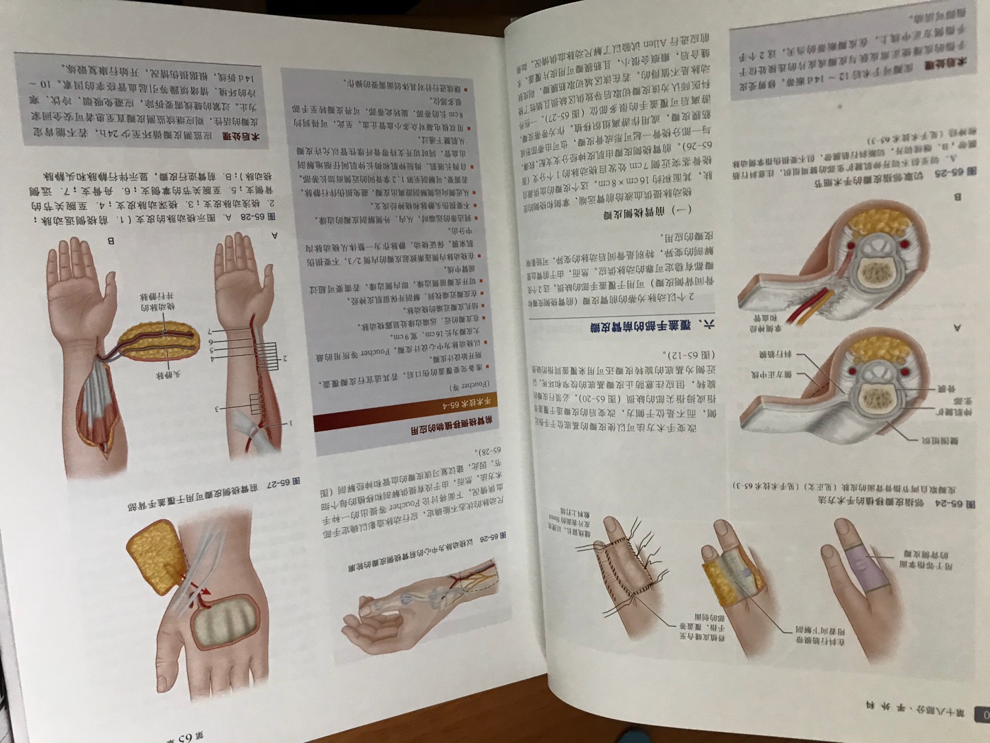 典藏版就是不一样，纸张很好，内容是坎贝尔的，当然没得说了，权威的经典！就是物流有点儿暴力，书皮烂了点儿