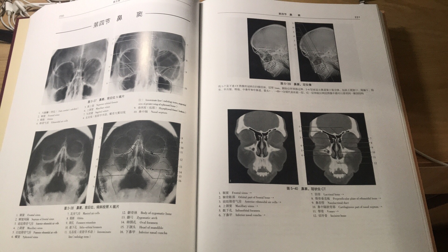 是之前那本影像解剖的第三版 今年刚出版的 比03年那版图片清晰  快递很快 之前那本因为物流折损了一个角 联系客服后很快给换了新的  就是换新的竟然没有纸壳包着了 就只有一个袋子 还好这本没有破损 第二天就到了 赞 给客服一个么么哒