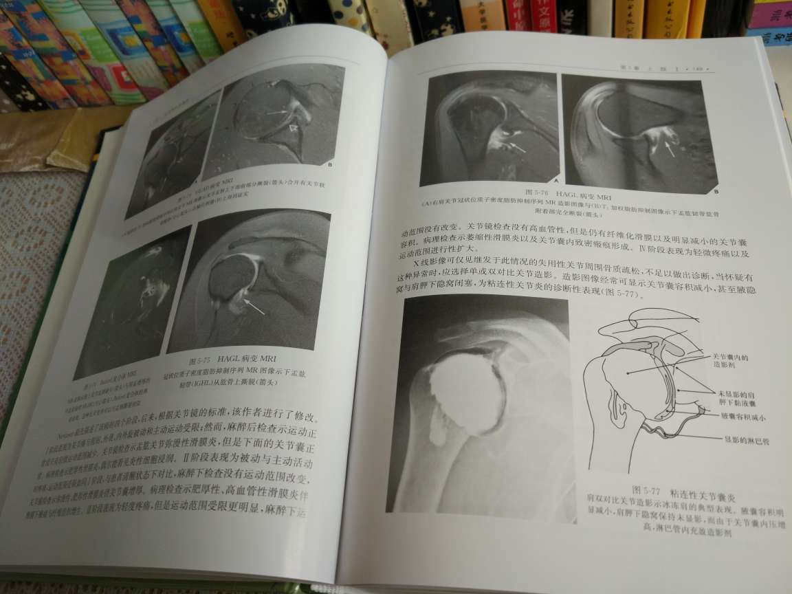 骨关节影像学巨著，经典好书，案头查资料必备。