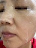 欧莱雅黑精华面膜4.0 5片 保湿补水修护紧致面部护肤品母亲节礼物送妈妈 实拍图