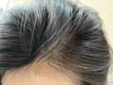藏奇迹（ZANGQIJI）洗发水控油蓬松改善毛躁控油留香防脱育发液男女士伊路依露 发全新升级包装 藏奇迹洗发水1瓶体验装300ML 实拍图