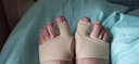蓓戈 大拇指外翻脚趾矫正器纠正器矫正带袜套拇外翻大脚骨大脚趾头脚指矫正器分趾器成人男女可穿鞋 拇指外翻矫正器肤色 L码（适合40-48码） 实拍图