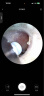 bebird 智能可视挖耳勺镊子洁耳仪掏耳朵神器采耳清洁工具 Note5 星空蓝 实拍图