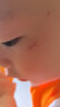 芭克kelocote美国疤克巴克硅凝胶儿童疤痕改善辅助祛 疤膏疤痕膏治疗改善疤痕 儿童装6g 实拍图