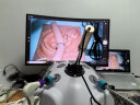 Lap Game腹腔镜模拟训练器械 腹腔镜手术模拟训练器 胸腔镜训练箱 腔镜模拟器 单孔练习 30度 连电脑版仿生体+30度可调焦镜头+模块+4器械 晒单实拍图
