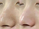 SULLIMN可视化吸黑头仪器大吸力粉刺黑头清理神器电动毛孔清洁仪器美容院家用面部美容仪送男女士生日礼物 【珍珠白】50倍放大可视黑头仪-3种清洁吸嘴 实拍图
