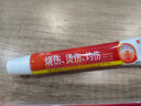 葵花烫伤膏烧伤膏开水热油烧烫伤湿润软膏抑菌凝胶疤痕肿创伤消肿 【消肿止痛】葵花医用生物创伤敷料 实拍图