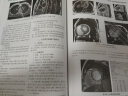 中华医学影像技术学·MR成像技术卷 实拍图