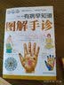 有病早知道：图解手诊 零基础学手诊手诊中医入门零基础学中医诊断中医书籍大全医书籍大全中医中医基础理论 实拍图