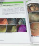 大肠EMR ESD操作基础及技巧 附视频 日本肠镜名师答疑解惑 常规内镜诊断 内镜治疗的辅助及培训书籍 实拍图