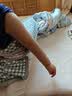 舒尔美医用淋巴水肿弹力袖套二级压力治疗型上肢绷带乳腺术后 无手款 XXL特大加号 实拍图