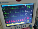 瑞博PM-9000A+12.1寸多参数监护仪心电监护仪家用医用监护仪 标配+锂电池 实拍图